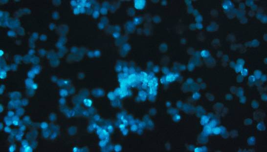 Новый уязвимый механизм: исследователи раскрыли, как остановить развитие лейкемии