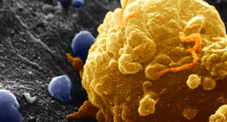 Рак и СПИД обнаружат за считанные секунды