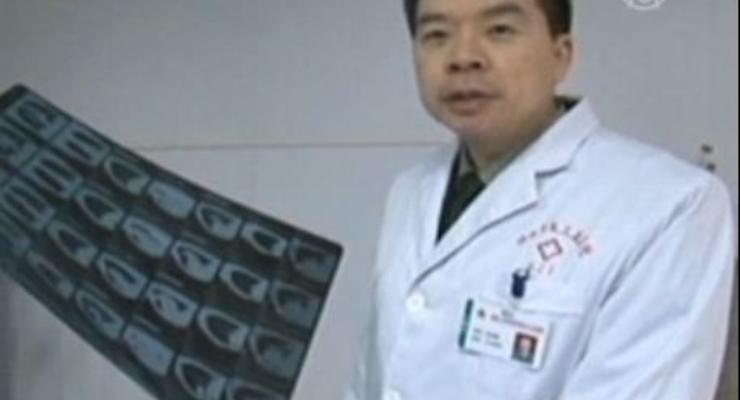 Китаянка 44 года прожила с термометром в легких