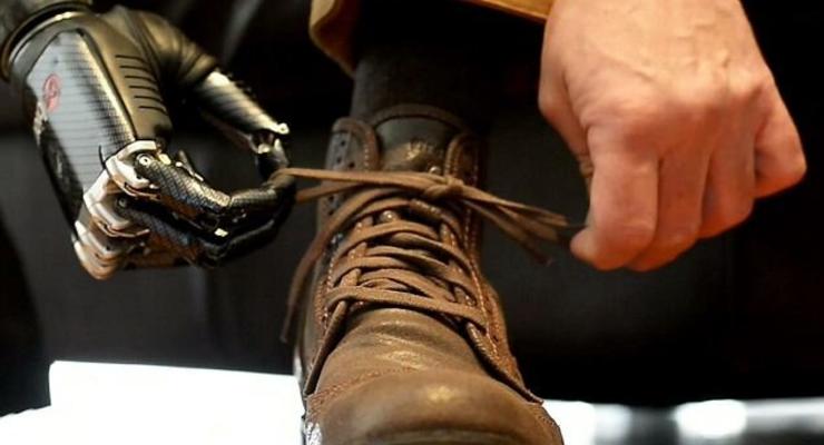 Человек с рукой Терминатора научился завязывать шнурки (ФОТО, ВИДЕО)