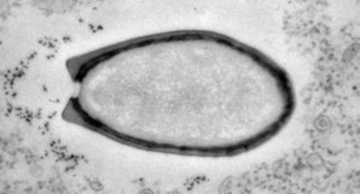 Вирусы Пандоры. Биологи отнесли гигантские вирусы к новой форме жизни