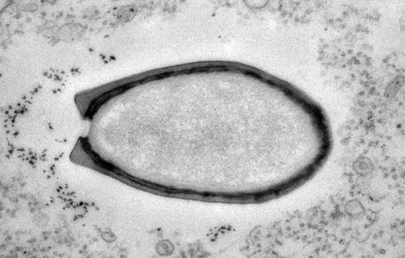 Найден гигантский вирус, который может быть пришельцем из космоса / Chantal Abergel and Jean-Michel Claverie