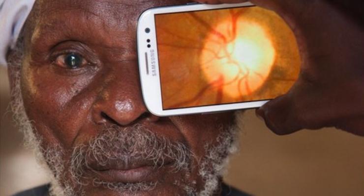 При помощи смартфона можно проверить зрение