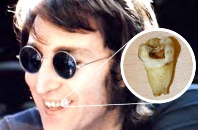 Зуб дают: Основателя The Beatles Джона Леннона хотят клонировать / itop.fm