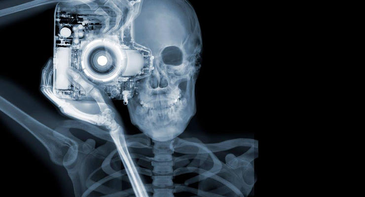 Внутренний мир: 30 удивительных рентгеновских фото