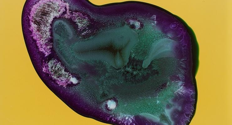 Убийственная красота: Невероятные фотографии наркотиков под микроскопом