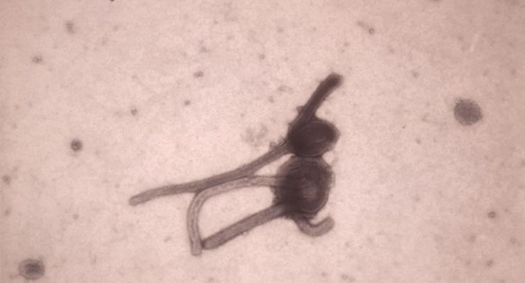 Ученые разработали новый метод изучения вируса Эболы