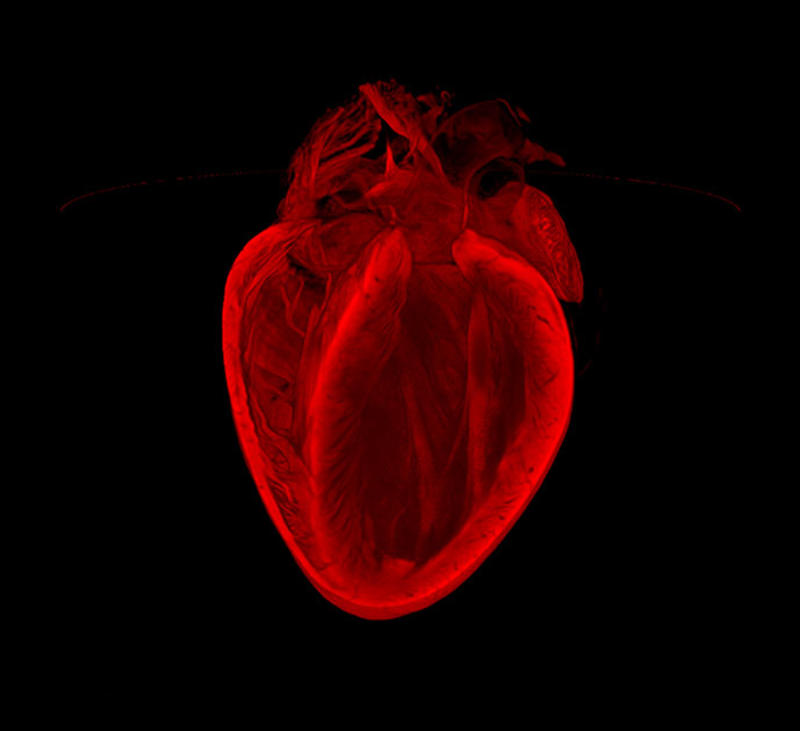Разбитое сердце: Лучшие фото из мира кардиологии / British Heart Foundation