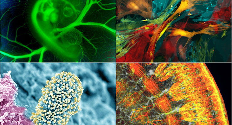 Сердце цыпленка, раковые клетки, нервы и бактерии: лучшие работы конкурса BioArt