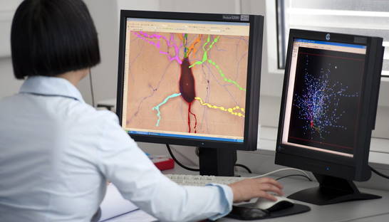 Мозг под кислотой: нейробиологи объяснили последствия применения LSD