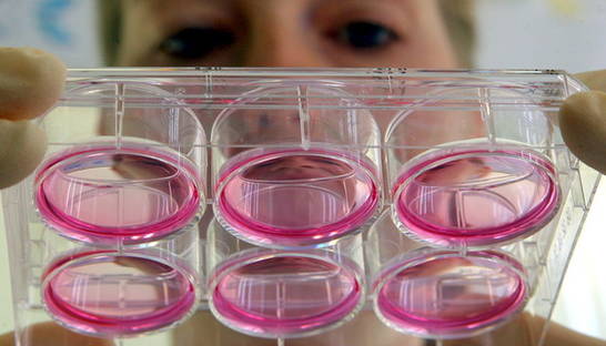 Биологи из Лозанны раскрыли секрет омоложения