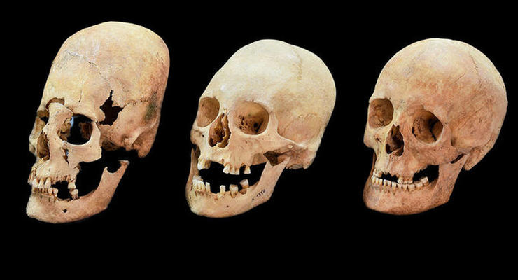 Найденные в Германии вытянутые черепа оказались невестами с востока