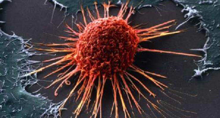 Ученые: В распространении рака виновато человечество