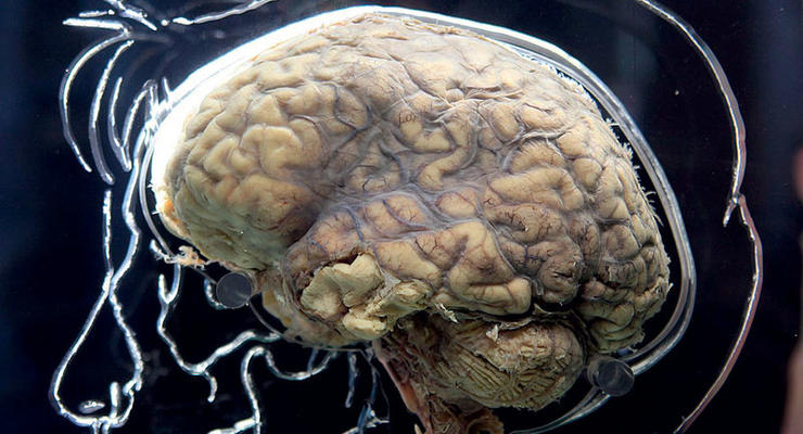 Биологи создали разрушающую мозг молекулу