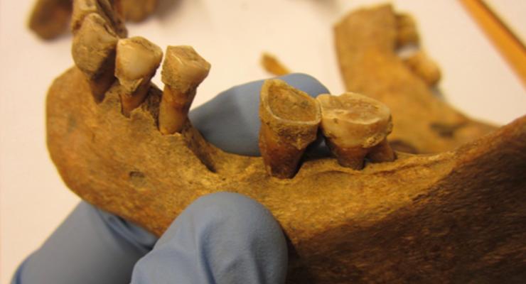 Зубной камень раскрыл секрет питания средневековых людей