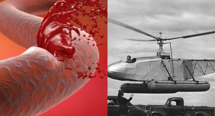 День в истории: 17 апреля - Первый вертолет-амфибия и день гемофилии