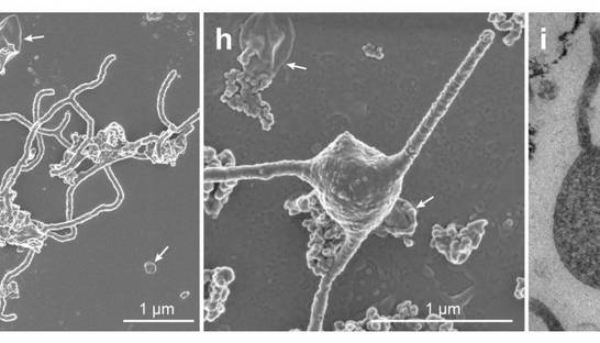 Ученые вырастили в лаборатории новую форму жизни
