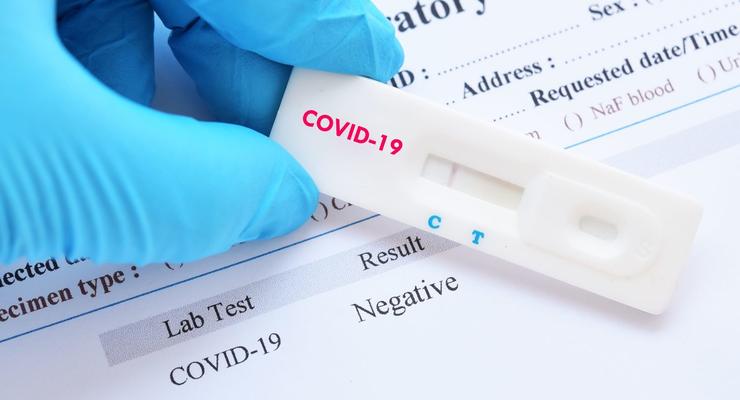 Создан быстрый и простой тест на коронавирус