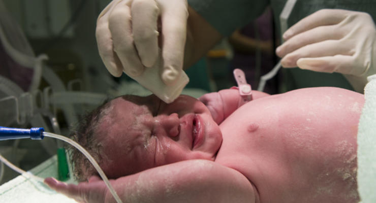 У новорожденного обнаружили аномальное количество частиц коронавируса