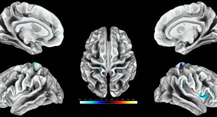 Ученые нашли связь между мозгом и клитором