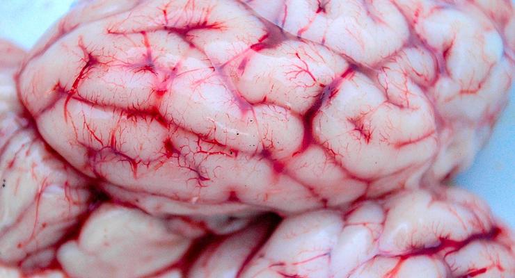 Ученые поняли, как умирает мозг