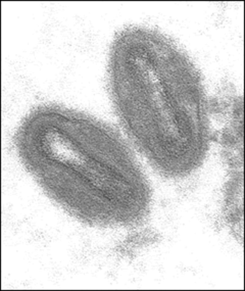 Микрофотография вируса оспы обезьян - wikipedia