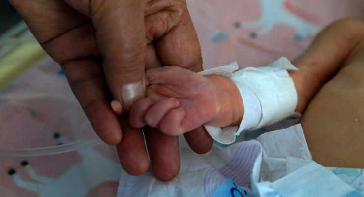 Украинские врачи сеткой отделили органы трехдневного ребенка