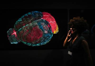 Боли в голове: озвучиваем все, что вы могли не знать