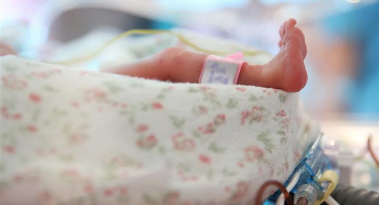 В НСЗУ напомнили об услугах для преждевременно рожденных младенцев