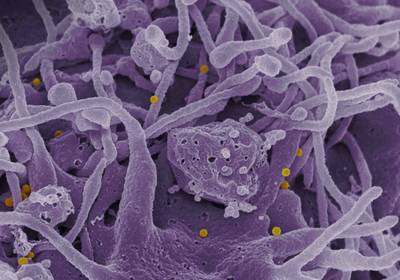 Смертельный вирус ККГЛ: симптомы и где его зафиксировали