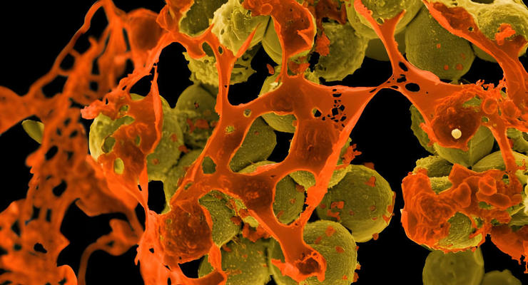 В Житомирской области нашли бактерии, которым 1,5 млрд лет