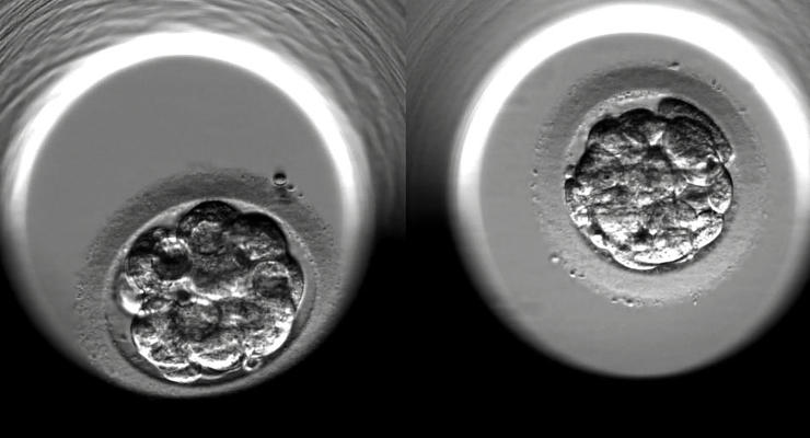 Это прорыв: в лаборатории вырос человеческий эмбрион