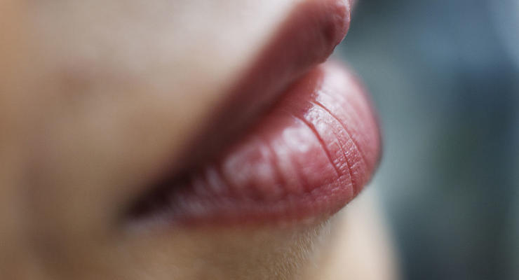 Найбільші губи у світі: жінка показала себе до операцій