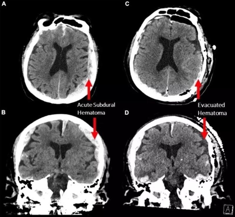 Фото - Frontiers in Ageing Neuroscience