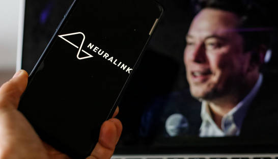 Будут чипированы миллионы: у Илона Маска дали прогноз